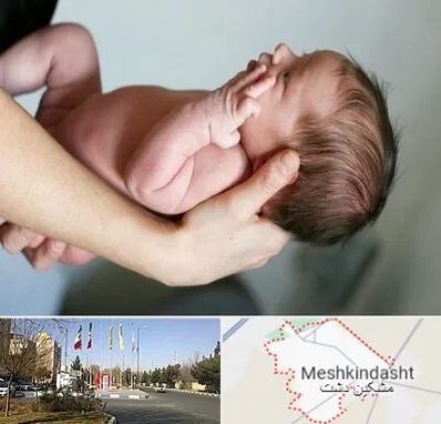 درمان نازایی در مشکین دشت