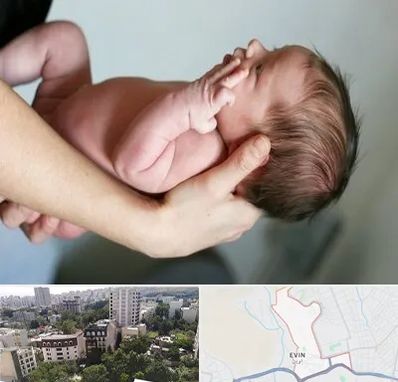 درمان نازایی در اوین