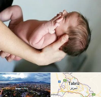 درمان نازایی در تبریز