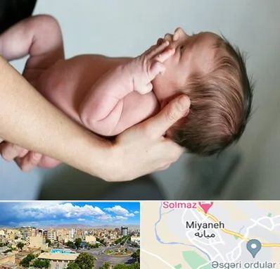 درمان نازایی در میانه