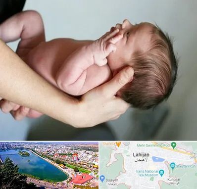 درمان نازایی در لاهیجان