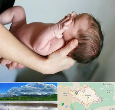 درمان نازایی در مرند