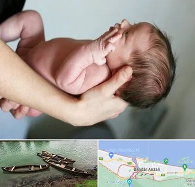 درمان نازایی در بندر انزلی