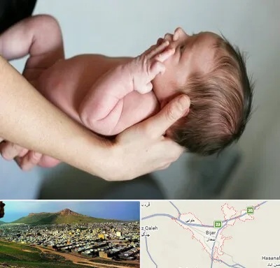 درمان نازایی در بیجار