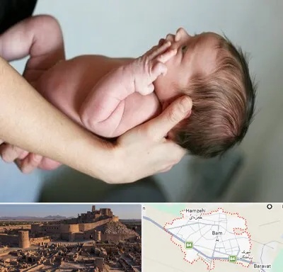 درمان نازایی در بم