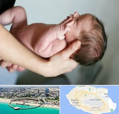 درمان نازایی در کیش