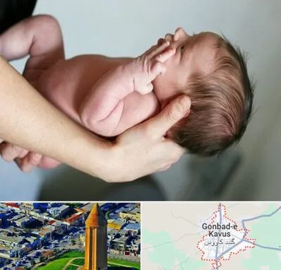 درمان نازایی در گنبد کاووس