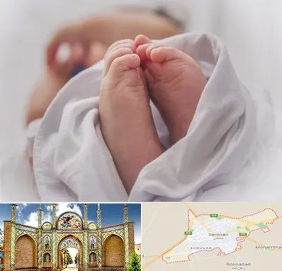 فوق تخصص تعیین جنسیت در سمنان