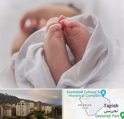 فوق تخصص تعیین جنسیت در زعفرانیه 