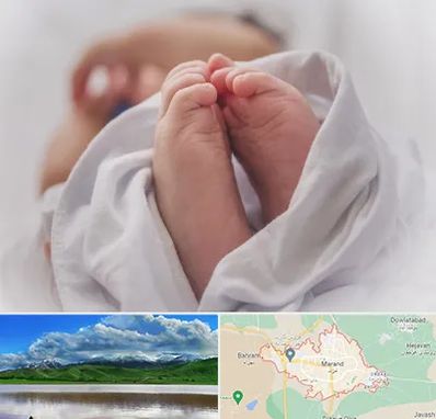 فوق تخصص تعیین جنسیت در مرند