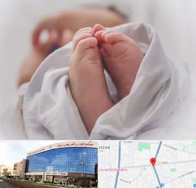 فوق تخصص تعیین جنسیت در نصف راه تبریز