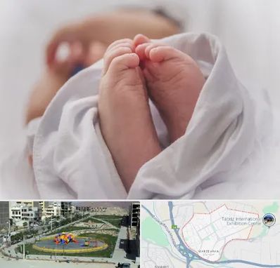 فوق تخصص تعیین جنسیت در مرزداران تبریز