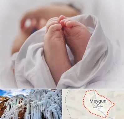 فوق تخصص تعیین جنسیت در میگون