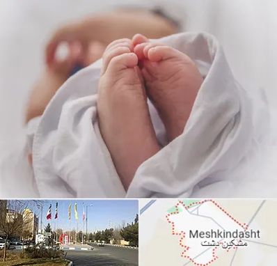 فوق تخصص تعیین جنسیت در مشکین دشت