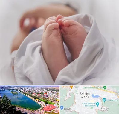 فوق تخصص تعیین جنسیت در لاهیجان