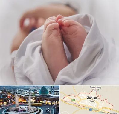 فوق تخصص تعیین جنسیت در زنجان