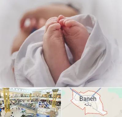 فوق تخصص تعیین جنسیت در بانه