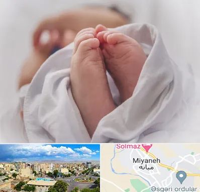 فوق تخصص تعیین جنسیت در میانه