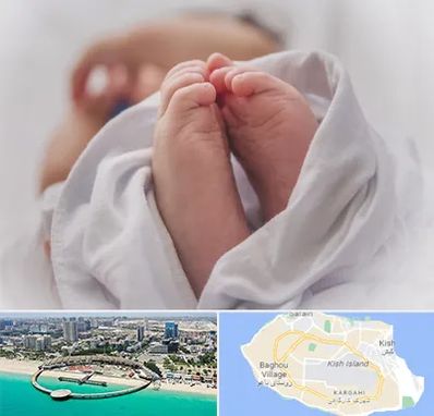 فوق تخصص تعیین جنسیت در کیش