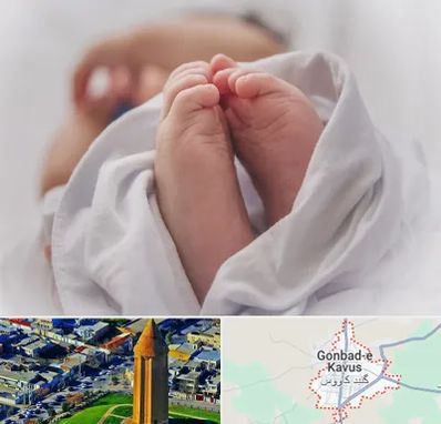 فوق تخصص تعیین جنسیت در گنبد کاووس
