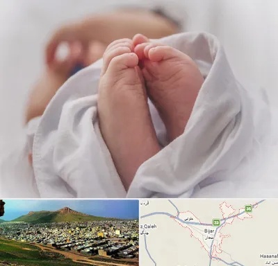 فوق تخصص تعیین جنسیت در بیجار
