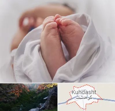 فوق تخصص تعیین جنسیت در کوهدشت