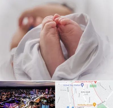 فوق تخصص تعیین جنسیت در گلسار رشت 