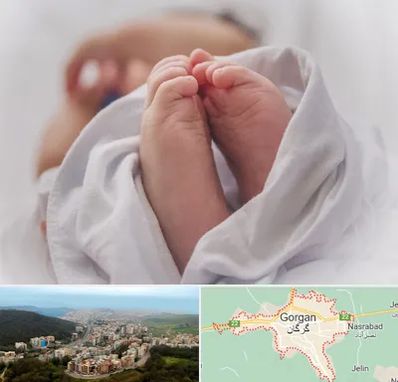 فوق تخصص تعیین جنسیت در گرگان