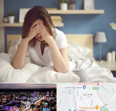 درمان زگیل تناسلی زنان در گلسار رشت 