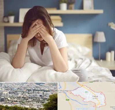 درمان زگیل تناسلی زنان در یاسوج