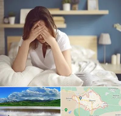 درمان زگیل تناسلی زنان در مرند