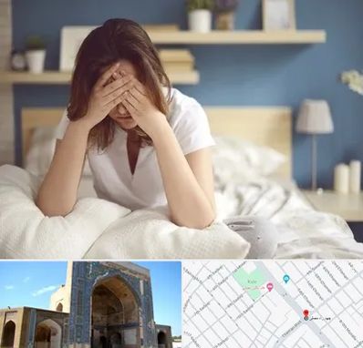 درمان زگیل تناسلی زنان در مصلی مشهد