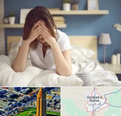 درمان زگیل تناسلی زنان در گنبد کاووس