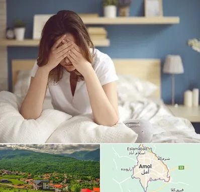 درمان زگیل تناسلی زنان در آمل