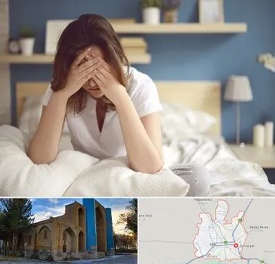 درمان زگیل تناسلی زنان در اهر