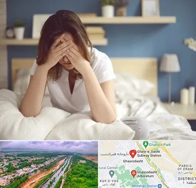 درمان زگیل تناسلی زنان در قصرالدشت شیراز