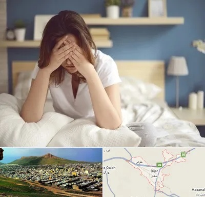 درمان زگیل تناسلی زنان در بیجار