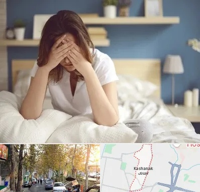 درمان زگیل تناسلی زنان در کاشانک
