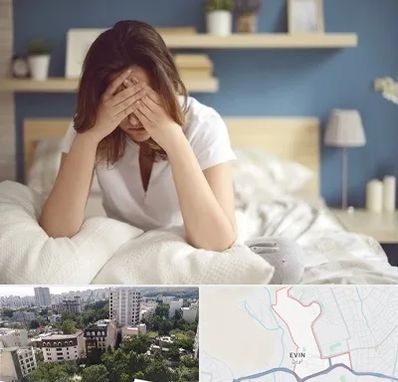 درمان زگیل تناسلی زنان در اوین