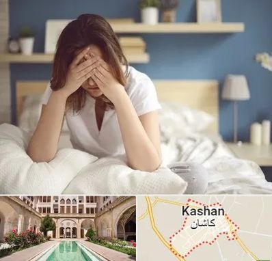 درمان زگیل تناسلی زنان در کاشان