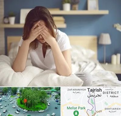 درمان زگیل تناسلی زنان در تجریش 