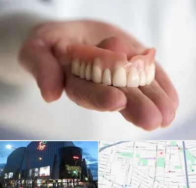 لیفت لثه با لیزر در بلوار اباذر