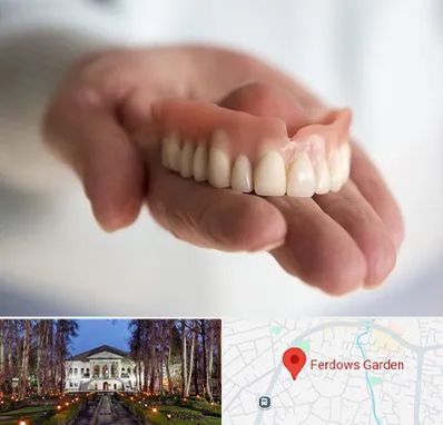 لیفت لثه با لیزر در باغ فردوس