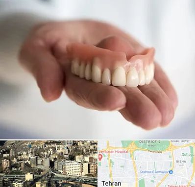 لیفت لثه با لیزر در مرزداران 