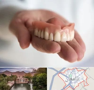 لیفت لثه با لیزر در دامغان