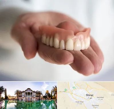 لیفت لثه با لیزر در شیراز