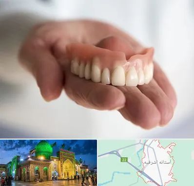 لیفت لثه با لیزر در آستانه اشرفیه
