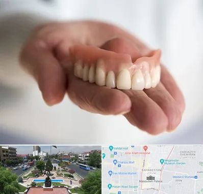 لیفت لثه با لیزر در بهارستان 