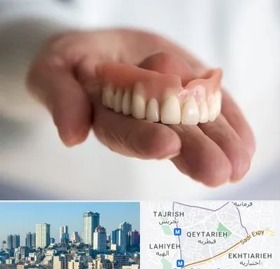 لیفت لثه با لیزر در قیطریه 