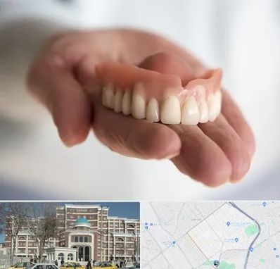 لیفت لثه با لیزر در طلاب مشهد